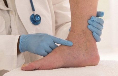 How to Identify and Treat Poor Blood Circulation