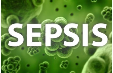Sepsis: What you need to know